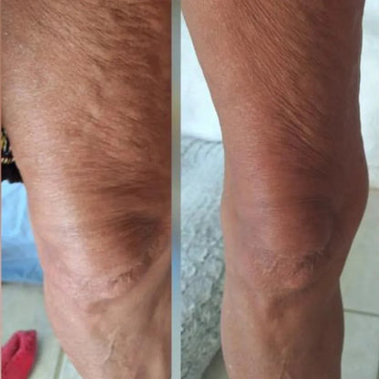 Transforma tu piel con el  Aceite Anticelulítico Natural